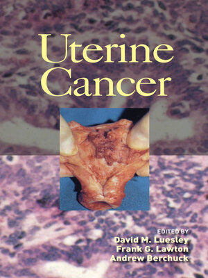cover image of Uterine Cancer